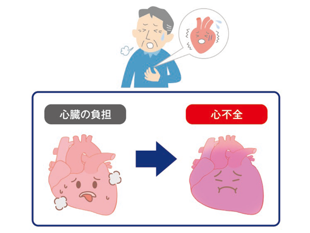 心不全イメージ